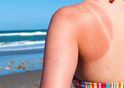 Skin Troubles